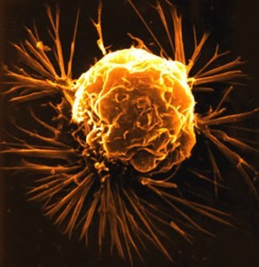 Carcinosinum