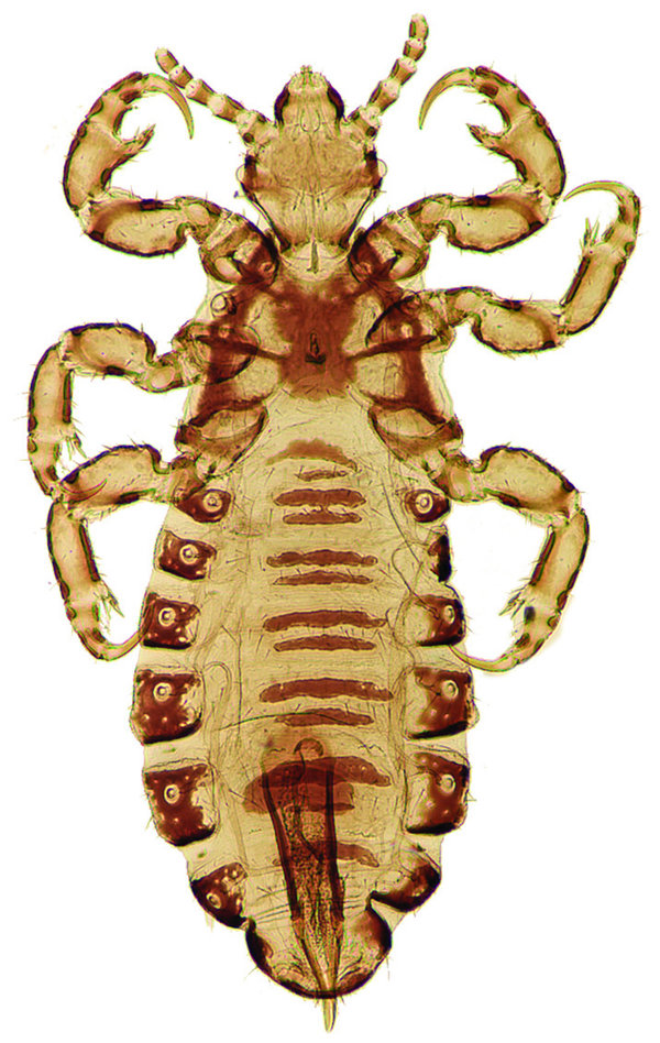 Pediculus